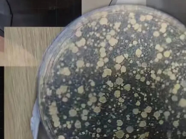 测出细菌、真菌几十万!很多人用的这个物品,可能比酒店浴巾还脏