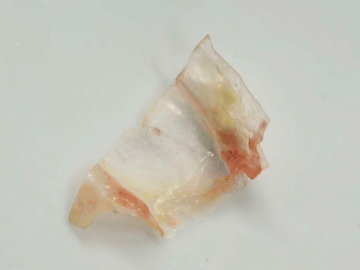 X门诊|七岁女童反复喘息久治不愈,竟是一片塑料薄膜藏在气道里
